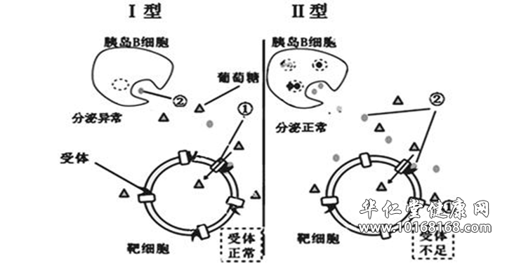 糖尿病