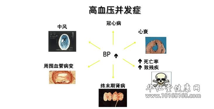高血压并发症.png